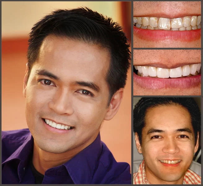 Aesthetic Smile Designs 1