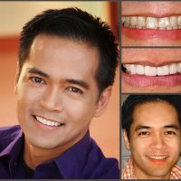 Aesthetic Smile Designs ico