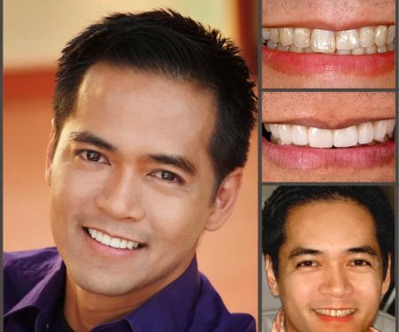 Aesthetic Smile Designs