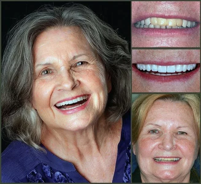Aesthetic Smile Designs 7