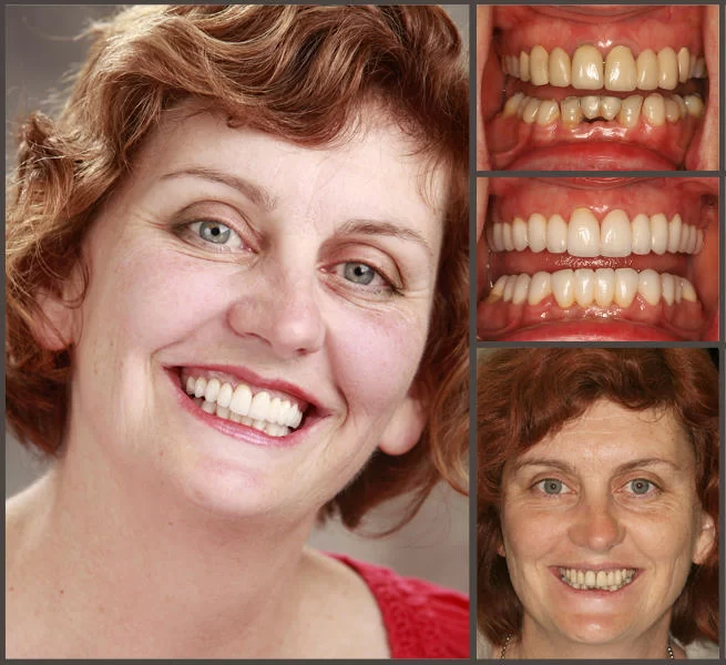 Aesthetic Smile Designs 5