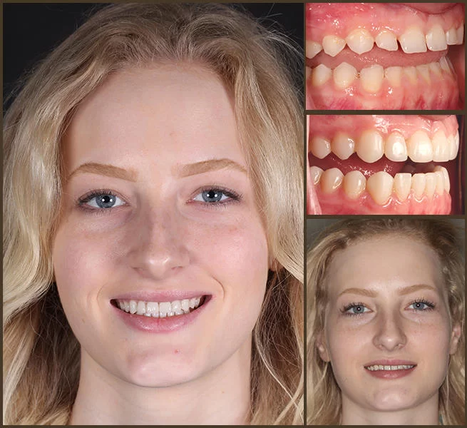 Aesthetic Smile Designs 4