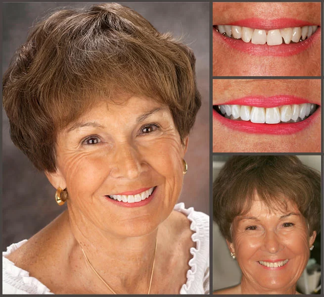 Aesthetic Smile Designs 2