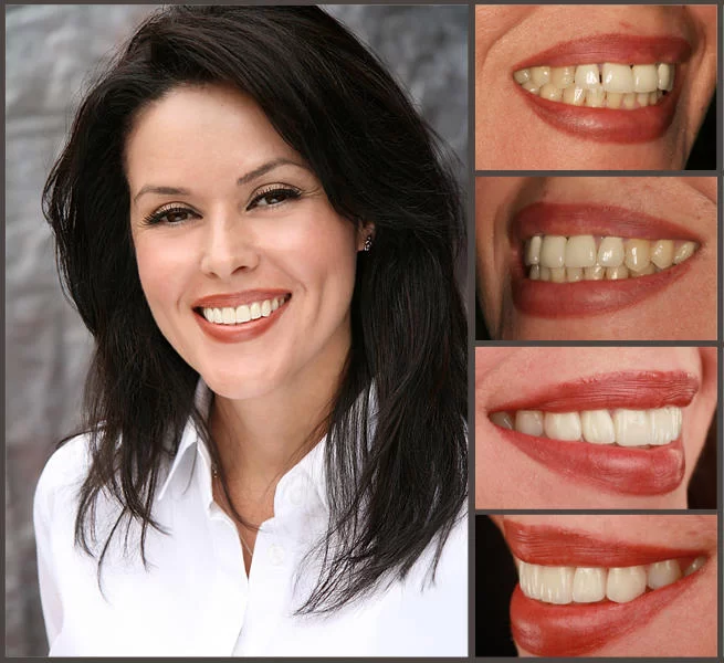 Aesthetic Smile Designs 3