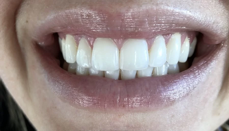 Personalee Dental Picture 3