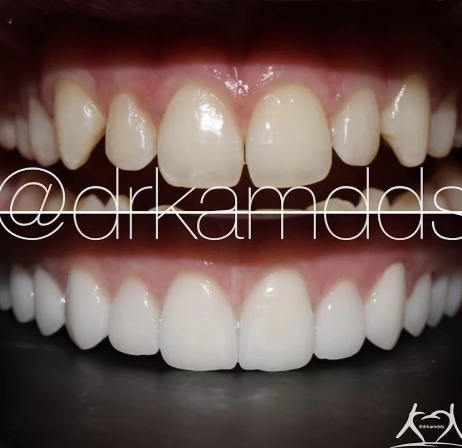 Agoura Advanced Dentistry - Dr. Kambiz Kamangar DDS 9