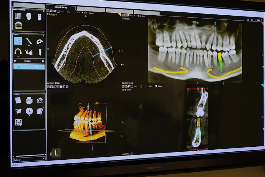 Robert G. Hale DDS Implant Center 8