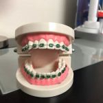 North Las Vegas Orthodontics