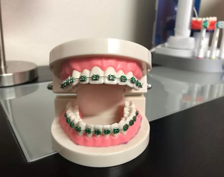 North Las Vegas Orthodontics