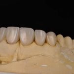 Pristine Dental Service