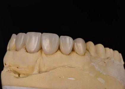 Pristine Dental Service