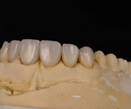 Pristine Dental Service