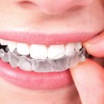 Smile Squad Kids Dentistry & Braces