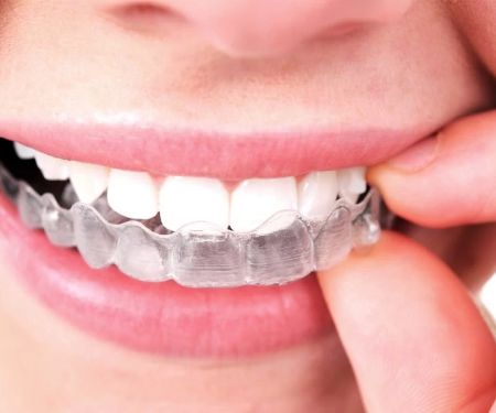 Smile Squad Kids Dentistry & Braces