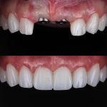 Modern Smiles