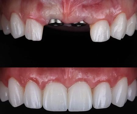 Modern Smiles