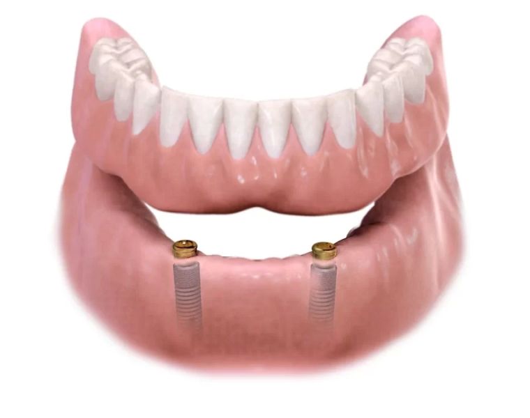 City Dental- Dental Implants and Orthodontics