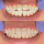 Zen Dental