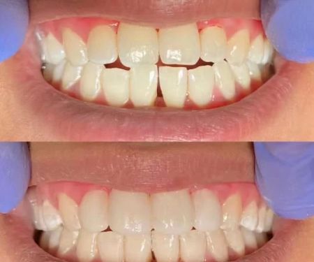 Zen Dental