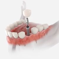 Denture Care Services ico