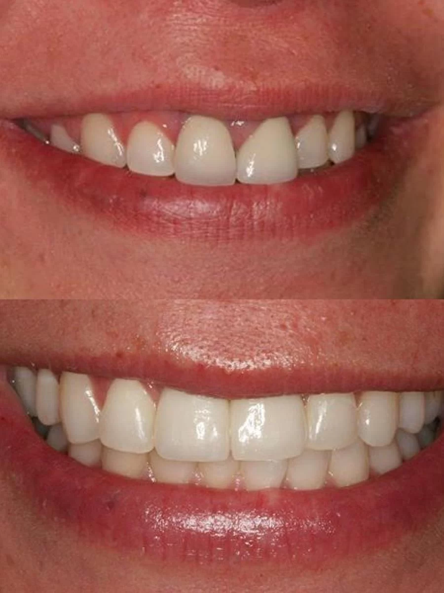 Saghi Parham D.D.S. - Beverly Hills Cosmetic & Restorative Dentistry 9