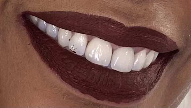 Saghi Parham D.D.S. - Beverly Hills Cosmetic & Restorative Dentistry 4