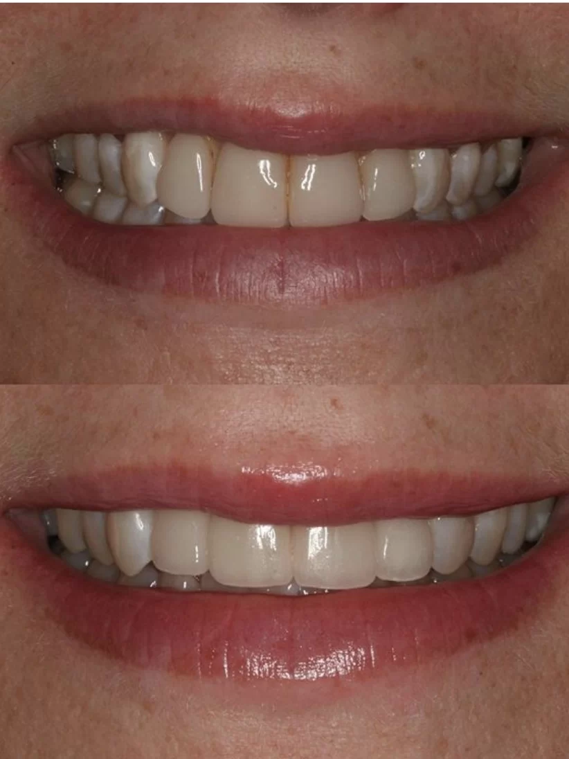 Saghi Parham D.D.S. - Beverly Hills Cosmetic & Restorative Dentistry 8
