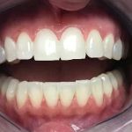 Carey Family Dentistry LLC