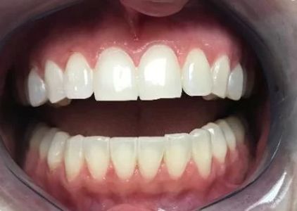 Carey Family Dentistry LLC