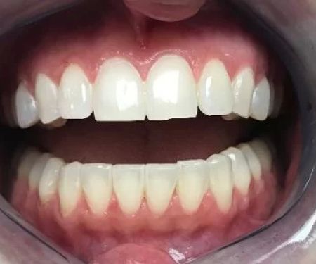 Carey Family Dentistry LLC