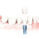 Sayreville Dental