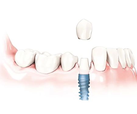 Sayreville Dental