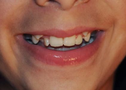 Dentista Franciss Zamora DDS