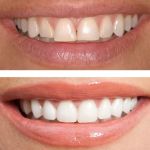 Fraser Dentistry