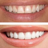 Fraser Dentistry ico