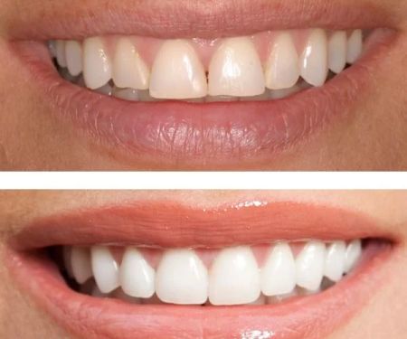 Fraser Dentistry