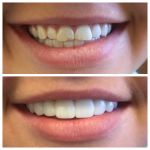Maryam Hadian, DDS | Le Chic Dentist Los Angeles, CA