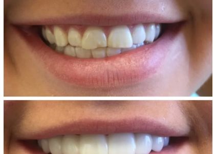 Maryam Hadian, DDS | Le Chic Dentist Los Angeles, CA