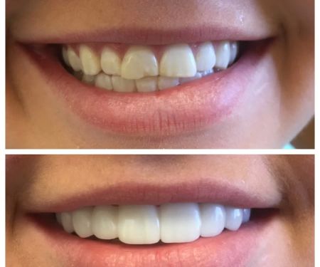 Maryam Hadian, DDS | Le Chic Dentist Los Angeles, CA