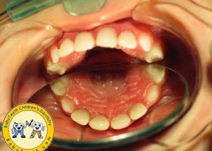 BabyTeeth Children's Dentistry