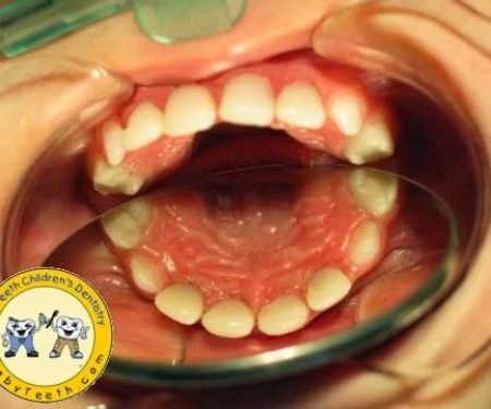 BabyTeeth Children's Dentistry