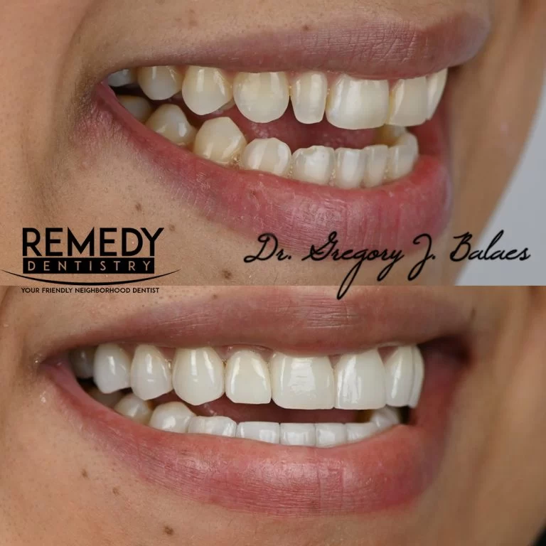 Remedy Dentistry: Comprehensive Cosmetic Dental Care 7