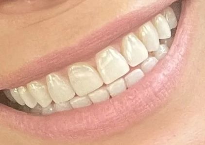 Cranford Family Dentistry