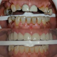Smile Makers ico