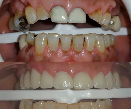 Smile Makers
