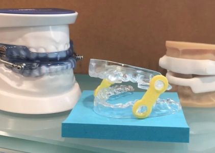 Advanced Dental of Holmdel - Dr. Rachel E. Pickworth and Dr. Yostina Kaldas