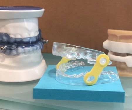 Advanced Dental of Holmdel - Dr. Rachel E. Pickworth and Dr. Yostina Kaldas