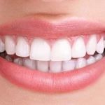 Creative Smiles