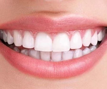Creative Smiles