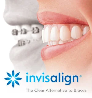 Isaacson Orthodontics 3